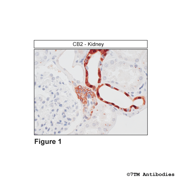 Immunohistochemical identification of the Cannabinoid Receptor 2 in kidney