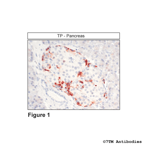 Immunohistochemical identification of TP Tromboxane Receptor in pancreas