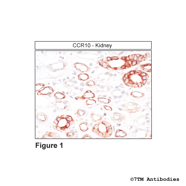  Immunohistochemical identification of CC Chemokine Receptor 10 in kidney