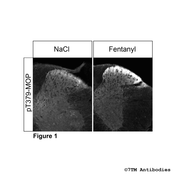  Immunohistochemical Identification of Agonist-induced Threonine379 phosphorylation of the µ-Opioid Receptor in mouse spinal cord