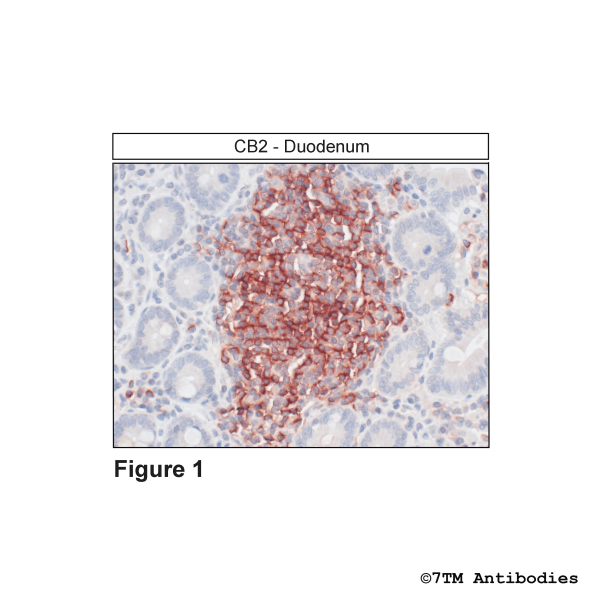 CB2 (GP-IHC-grade) Cannabinoid Receptor 2 Antibody, Guinea Pig