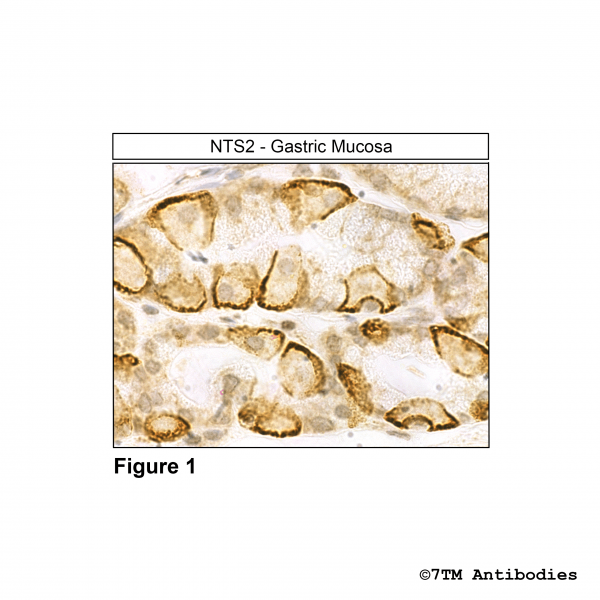 NTS2 (IHC-grade), Neurotensin Receptor 2 Antibody