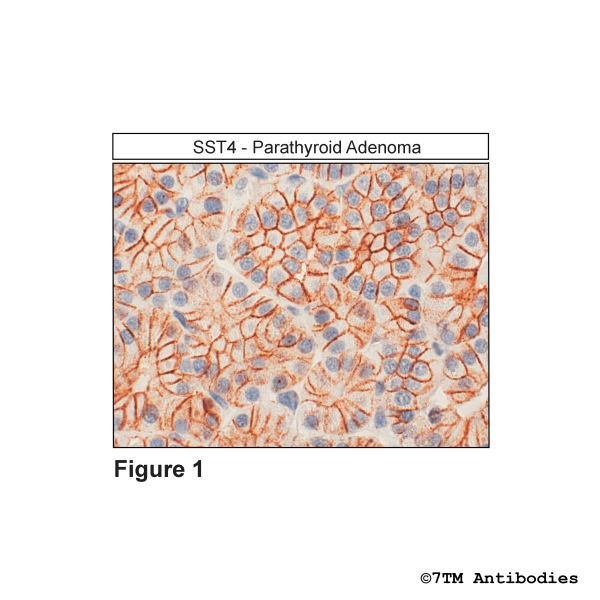 SST4 [UMB9] (RM-IHC-grade), Somatostatin Receptor 4 Antibody, Rabbit Monoclonal