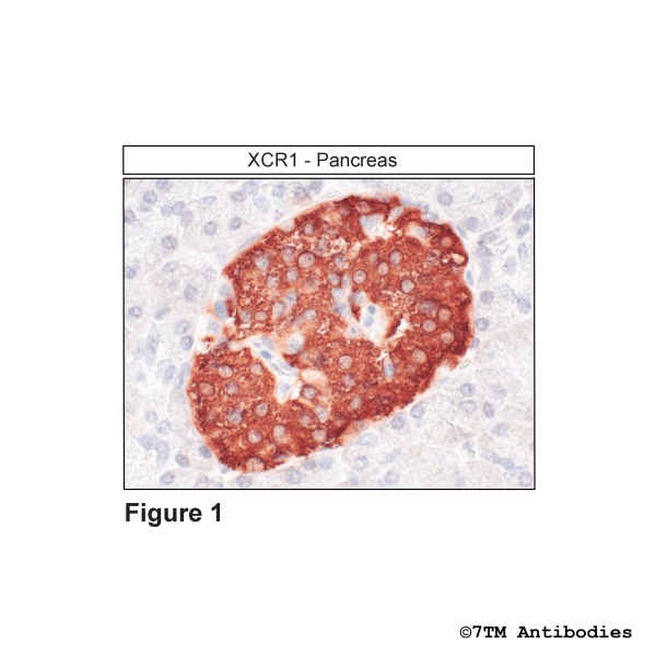 Immunohistochemical identification of XCR Chemokine Receptor 1 in pancreas