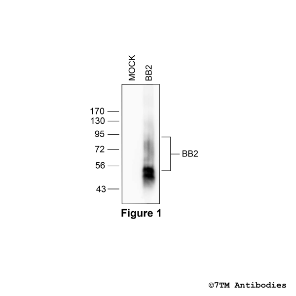 Validation of the Bombesin Receptor 2 in transfected HEK293 cells.